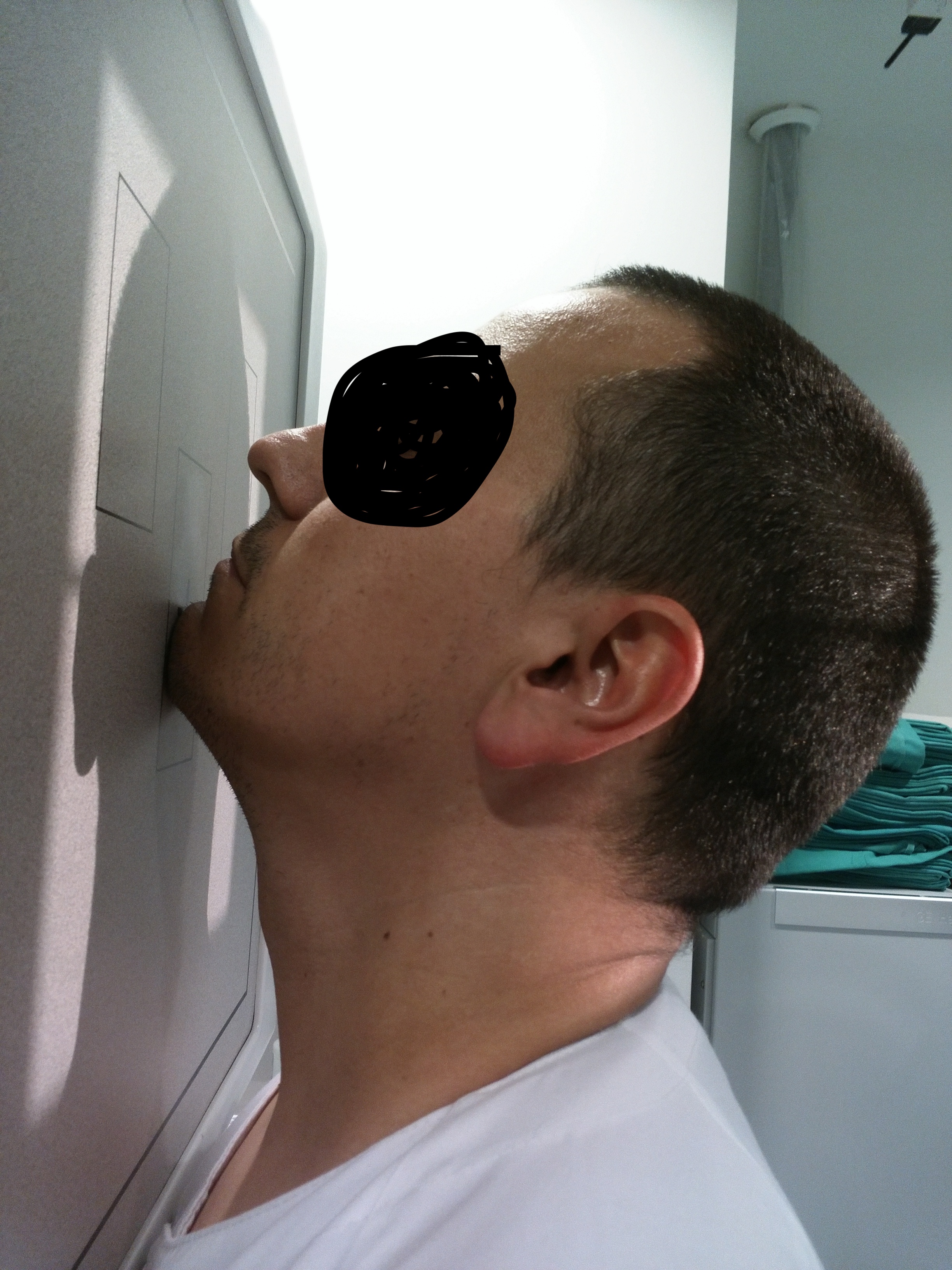 Skull Axial Towne Projection